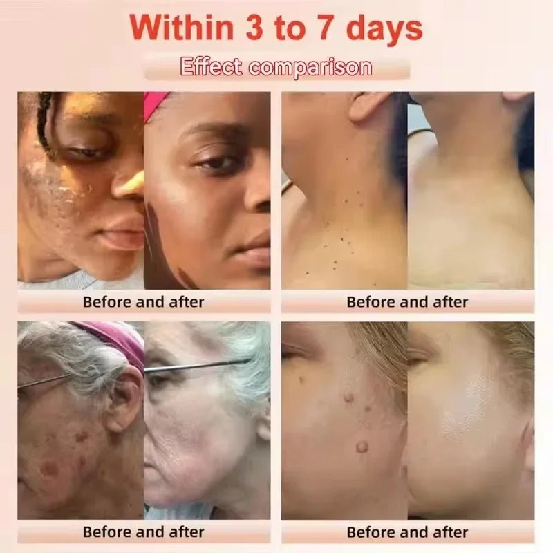 Revitalize Skin Fruit Acid Peeling Gel Facial Cleansing Exfoliating Peeling Scrub Deep Clean Acne Blackhead Remove Face Cleanser - STAND OUT FLEXSARAH